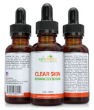 Clear Skin Acne, Age-Defying Serum + Tea Tree oil, Vitamin C, Retinol, Niacinamide & Salicylic Acid